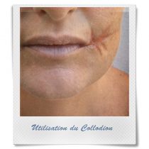 COLLE LIQUIDE COLLODION 11 ML