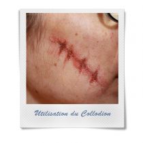 COLLE LIQUIDE COLLODION 11 ML