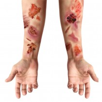 TATOUAGES ÉPHÉMÈRES BLESSURES PLAIES INFECTÉES